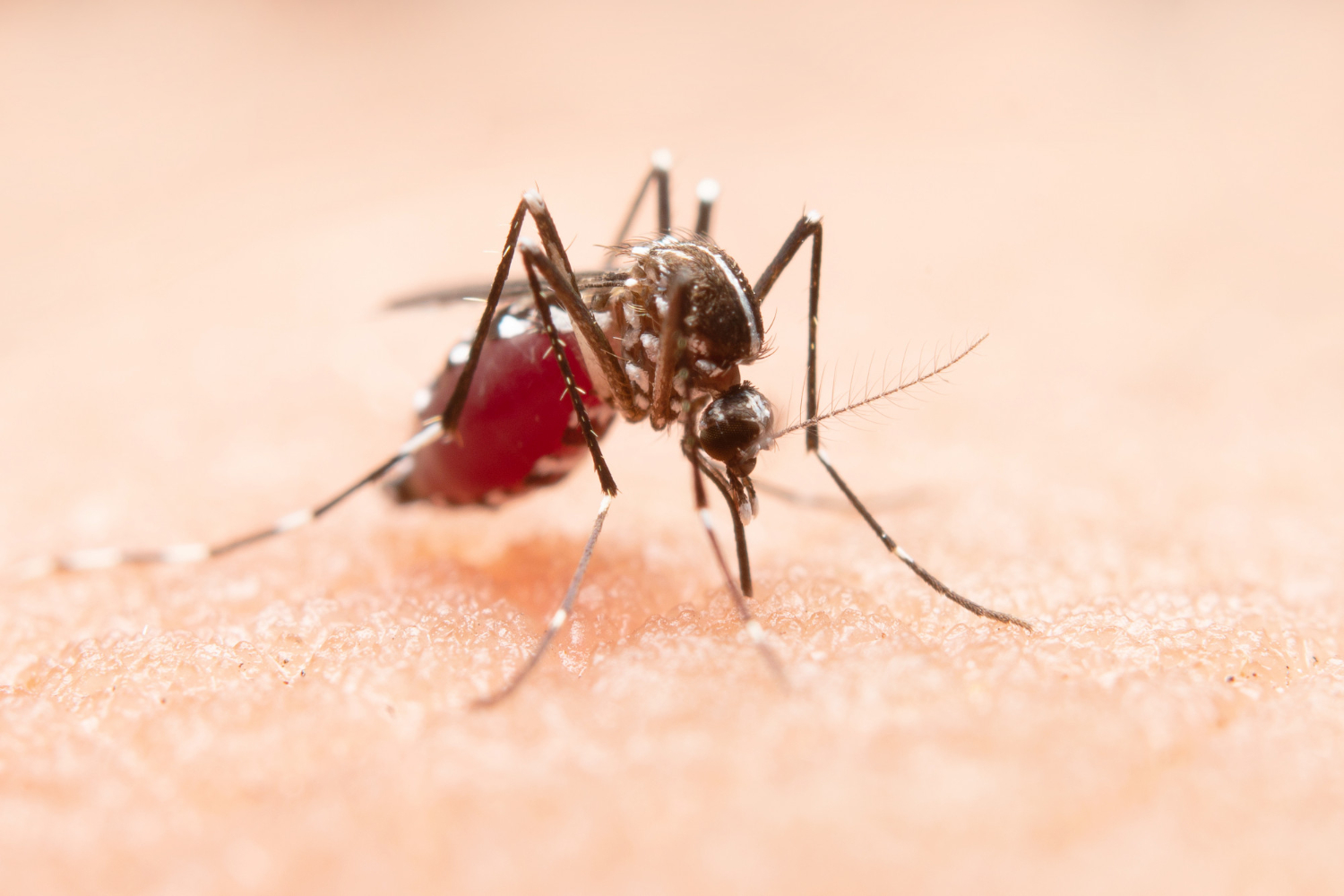 Dengue Fever: Signs and Symptoms