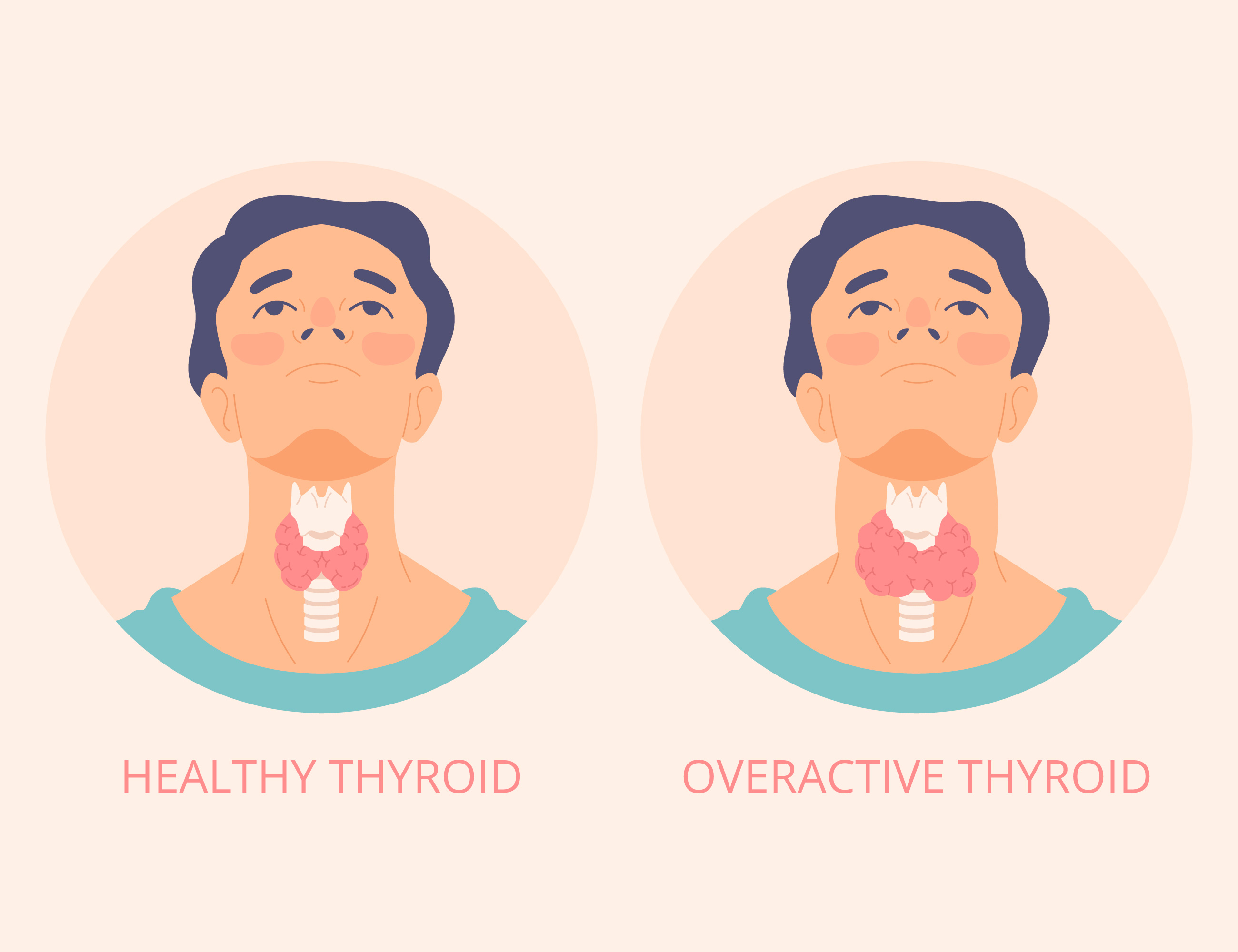 Natural Home Remedies for Thyroid Health: Tips for Wellness